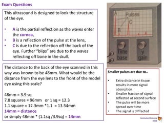 Animated Science
2016
This ultrasound is designed to look the structure
of the eye.
• A is the partial reflection as the waves enter
the cornea,
• B is a reflection of the pulse at the lens,
• C is due to the reflection off the back of the
eye. Further “blips” are due to the waves
reflecting off bone in the skull.
Exam Questions
The distance to the back of the eye scanned in this
way was known to be 48mm. What would be the
distance from the eye lens to the front of the model
eye using this scale?
48mm = 3.9 sq
7.8 squares = 96mm or 1 sq = 12.3
1.1 square = 12.3mm *1.1 = 13.54mm
14mm = distance
or simply 48mm * (1.1sq /3.9sq) = 14mm
Smaller pulses are due to..
• Extra distance in tissue
results in more signal
absorption
• Smaller fraction of signal
reflected at second surface
• The pulse will be more
spread over time
• The signal is diffracted
 