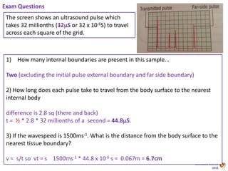 Animated Science
2016
The screen shows an ultrasound pulse which
takes 32 millionths (32S or 32 x 10-6S) to travel
across each square of the grid.
Exam Questions
1) How many internal boundaries are present in this sample...
Two (excluding the initial pulse external boundary and far side boundary)
2) How long does each pulse take to travel from the body surface to the nearest
internal body
difference is 2.8 sq (there and back)
t = ½ * 2.8 * 32 millionths of a second = 44.8S.
3) If the wavespeed is 1500ms-1. What is the distance from the body surface to the
nearest tissue boundary?
v = s/t so vt = s 1500ms-1 * 44.8 x 10-6 s = 0.067m = 6.7cm
 