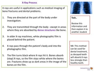 Animated Science
2016
X-Ray Process
X-rays are useful in applications such as medical imaging of
bone fractures and dental problems.
1. They are directed at the part of the body under
investigation.
2. They are transmitted through the body - except in areas
where they are absorbed by dense structures like bone.
3. In older X-ray machines, white photographic film is
placed behind the patient.
4. X-rays pass through the patient’s body and into the
photographic film.
5. The film turns black where X-rays hit it. Bones absorb
(stop) X-rays, so the film stays white where the bones
are. Fractures show up as dark areas in the image of the
bones on the film.
NB: This method
can be used for
dental treatment,
as decayed teeth
will absorb X-rays
less strongly than
healthy teeth.
Task..
Review this
information and
then explain it to
another student
 