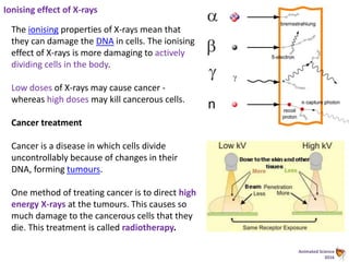 Animated Science
2016
Ionising effect of X-rays
The ionising properties of X-rays mean that
they can damage the DNA in cells. The ionising
effect of X-rays is more damaging to actively
dividing cells in the body.
Low doses of X-rays may cause cancer -
whereas high doses may kill cancerous cells.
Cancer treatment
Cancer is a disease in which cells divide
uncontrollably because of changes in their
DNA, forming tumours.
One method of treating cancer is to direct high
energy X-rays at the tumours. This causes so
much damage to the cancerous cells that they
die. This treatment is called radiotherapy.
 