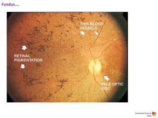 Animated Science
2016
Fundus….
 