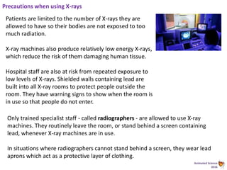 Animated Science
2016
Precautions when using X-rays
Patients are limited to the number of X-rays they are
allowed to have so their bodies are not exposed to too
much radiation.
X-ray machines also produce relatively low energy X-rays,
which reduce the risk of them damaging human tissue.
Hospital staff are also at risk from repeated exposure to
low levels of X-rays. Shielded walls containing lead are
built into all X-ray rooms to protect people outside the
room. They have warning signs to show when the room is
in use so that people do not enter.
Only trained specialist staff - called radiographers - are allowed to use X-ray
machines. They routinely leave the room, or stand behind a screen containing
lead, whenever X-ray machines are in use.
In situations where radiographers cannot stand behind a screen, they wear lead
aprons which act as a protective layer of clothing.
 
