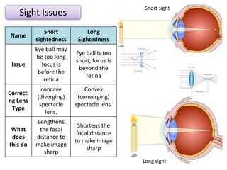 Sight Issues
Name
Short
sightedness
Long
Sightedness
Issue
Eye ball may
be too long
focus is
before the
retina
Eye ball is too
short, focus is
beyond the
retina
Correcti
ng Lens
Type
concave
(diverging)
spectacle
lens.
Convex
(converging)
spectacle lens.
What
does
this do
Lengthens
the focal
distance to
make image
sharp
Shortens the
focal distance
to make image
sharp
Short sight
Long sight
 