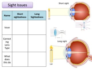 Sight Issues
Name
Short
sightedness
Long
Sightedness
Issue
Correct
ing
Lens
Type
What
does
this do
Short sight
Long sight
 