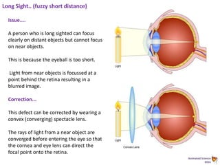 Animated Science
2016
Long Sight.. (fuzzy short distance)
Issue....
A person who is long sighted can focus
clearly on distant objects but cannot focus
on near objects.
This is because the eyeball is too short.
Light from near objects is focussed at a
point behind the retina resulting in a
blurred image.
Correction...
This defect can be corrected by wearing a
convex (converging) spectacle lens.
The rays of light from a near object are
converged before entering the eye so that
the cornea and eye lens can direct the
focal point onto the retina.
 