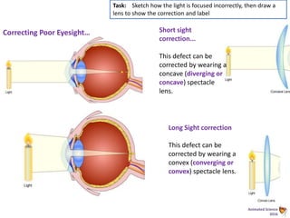 Animated Science
2016
Correcting Poor Eyesight… Short sight
correction...
This defect can be
corrected by wearing a
concave (diverging or
concave) spectacle
lens.
Task: Sketch how the light is focused incorrectly, then draw a
lens to show the correction and label
Long Sight correction
This defect can be
corrected by wearing a
convex (converging or
convex) spectacle lens.
 