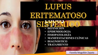 • DEFINICIÓN
• EPIDEMIOLOGIA
• FISIOPATOLOGÍA
• MANIFESTACIONES CLÍNICAS
• DIAGNOSTICO
• TRATAMIENTO
Fiorella Mogollón Zapata
LUPUS
ERITEMATOSO
SISTEMICO
 