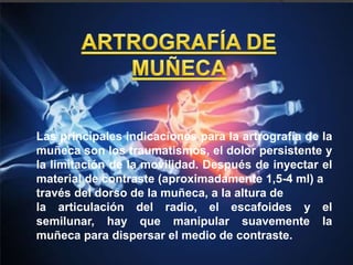 Las principales indicaciones para la artrografía de la
muñeca son los traumatismos, el dolor persistente y
la limitación de la movilidad. Después de inyectar el
material de contraste (aproximadamente 1,5-4 ml) a
través del dorso de la muñeca, a la altura de
la articulación del radio, el escafoides y el
semilunar, hay que manipular suavemente la
muñeca para dispersar el medio de contraste.
 