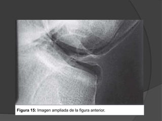 Figura 15: Imagen ampliada de la figura anterior.
 