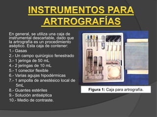 En general, se utiliza una caja de
instrumental descartable, dado que
la artrografía es un procedimiento
aséptico. Esta caja de contener:
1.- Gasas
2.- Un campo quirúrgico fenestrado
3.- 1 jeringa de 50 mL
4.- 2 jeringas de 10 mL
5.- 1 conector flexible
6.- Varias agujas hipodérmicas
7.- 1 ampolla de anestésico local de
5mL
8.- Guantes estériles
9.- Solución antiséptica
10.- Medio de contraste.
Figura 1: Caja para artrografía.
 