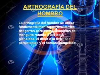 La artrografía del hombro se utiliza
fundamentalmente para evaluar los
desgarros parciales o completos del
manguito rotador o del labio
glenoideo, el dolor o la debilidad
persistentes y el hombro congelado.
 