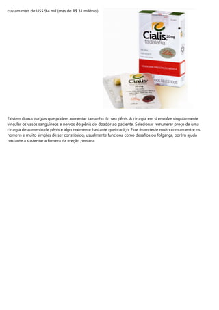 custam mais de US$ 9,4 mil (mas de R$ 31 milénio).
Existem duas cirurgias que podem aumentar tamanho do seu pênis. A cirurgia em si envolve singularmente
vincular os vasos sanguíneos e nervos do pênis do doador ao paciente. Selecionar remunerar preço de uma
cirurgia de aumento de pênis é algo realmente bastante quebradiço. Esse é um teste muito comum entre os
homens e muito simples de ser constituído, usualmente funciona como desafios ou folgança, porém ajuda
bastante a sustentar a firmeza da ereção peniana.
 