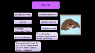 CAUSAS
Hipertensión Portal Insuficiencia Hepática
Huéspedes
inmunosuprimidos
Cirrosis
Síndrome Nefrótico
hiperbilirrubinemia
Hipoalbuminemia
Prolongación de tiempo de
protrombina y evidencia de
un Shunt porto sistémico
(varices esofágicas).
Procedimientos
invasivos (paracentesis,
diálisis peritoneal).
 