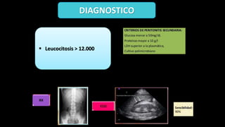 DIAGNOSTICO
 Leucocitosis > 12.000
 