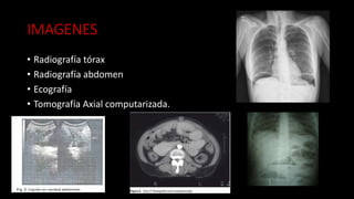 IMAGENES
• Radiografía tórax
• Radiografía abdomen
• Ecografía
• Tomografía Axial computarizada.
 
