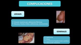 COMPLICACIONES
 Oclusión mecánica por adherencias fibrinosas
 Abscesos, fistulas, bridas y adherencias, evisceraciones
LOCALES
GENERALES
 Septicemia
 Shock
 Insuficiencia hepatorrenal y cardiaca
 Obstrucción intestinal
 