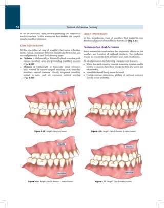 Sturdevant conservative dentistry book.. | PDF