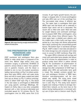 2015 Dec JIACD_Sticky Bone_Sohn et al | PDF
