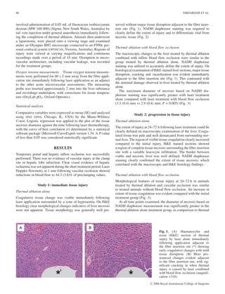 involved administration of 0.05 mL of fluorescein isothiocyanate
dextran (MW 160 000) (Sigma, New South Wales, Australia) by
tail vein injection under general anaesthesia immediately follow-
ing the completion of thermal ablation. Animals then underwent
a laparotomy, were placed onto a viewing stage and examined
under an Olympus BH2 microscope connected to an F990e per-
sonal confocal system (OPTISCAN, Victoria, Australia). Regions of
injury were viewed at varying magnifications and continuous
recordings made over a period of 15 min. Disruption in micro-
vascular architecture, including vascular leakage, was recorded
for the treatment groups.
Oxygen tension measurement. Tissue oxygen tension measure-
ments were performed for 60 s 2 mm away from the fibre appli-
cation site immediately following laser application as an adjunct
to the other acute microvascular assessments. The measuring
probe was inserted approximately 2 mm into the liver substance
and recordings undertaken, with corrections for tissue tempera-
ture (OxyLab pO2; Oxford Optronix).
Statistical analysis
Comparative variables were expressed as mean (SE) and analysed
using SPSS (SPSS, Chicago, IL, USA) by the Mann–Whitney
U-test. Logistic regression was applied to the plot of the tissue
necrosis diameter against the time following laser thermotherapy,
with the curve of best correlation (r) determined by a statistical
software package (Microsoft CurveExpert version 1.34. A P-value
of less than 0.05 was considered statistically significant.
RESULTS
Temporary portal and hepatic inflow occlusion was successfully
performed. There was no evidence of vascular injury at the clamp
site or hepatic lobe infarction. Clear visual evidence of hepatic
ischaemia was not apparent during the short treatment period. Laser
Doppler flowmetry at 1 min following vascular occlusion showed
reductions in blood flow to 44.3 (3.8)% of preclamping values.
Study 1: immediate tissue injury
Thermal ablation alone
Coagulative tissue change was visible immediately following
laser application surrounded by a zone of hyperaemia. On H&E
histology clear morphological changes indicative of liver necrosis
were not apparent. Tissue morphology was generally well pre-
served without major tissue disruption adjacent to the fibre inser-
tion site (Fig. 1). NADH diaphorase staining was required to
clearly define the extent of injury and to differentiate vital from
necrotic tissue (Fig. 2).
Thermal ablation with blood flow occlusion
The macroscopic changes in the liver treated by thermal ablation
combined with inflow blood flow occlusion were similar to the
group treated by thermal ablation alone. NADH diaphorase
staining was utilized to accurately define the extent of injury. On
histological examination of H&E stained liver sections, major tissue
disruption, cracking and vacuolization was evident immediately
adjacent to the fibre insertion site (Fig. 1). This contrasted with
the minimal damage observed in liver treated by thermal ablation
alone.
The maximum diameter of necrosis based on NADH dia-
phorase staining was significantly greater with laser treatment
alone compared with laser treatment with blood flow occlusion
(3.3 (0.4) mm vs 2.9 (0.4) mm; P = 0.005) (Fig. 3).
Study 2: progression in tissue injury
Thermal ablation alone
The extent of injury at 24–72 h following laser treatment could be
clearly defined on macroscopic examination of the liver. Coagu-
lated tissue was pale and well demarcated from surrounding nor-
mal liver. The region of visible tissue coagulation clearly increased
compared to the initial injury. H&E stained sections showed
a region of complete tissue necrosis surrounding the fibre insertion
site with a variable leucocyte infiltration. The border between
viable and necrotic liver was well defined. NADH diaphorase
staining clearly confirmed the extent of tissue necrosis, which
correlated with the macroscopic and H&E histology findings.
Thermal ablation with blood flow occlusion
Morphological features of tissue injury at 24–72 h in animals
treated by thermal ablation and vascular occlusion was similar
to treated animals without blood flow occlusion. An increase in
extent of tissue coagulation was evident compared with the initial
treatment group (Fig. 3).
At all time points examined, the diameter of necrosis based on
NADH diaphorase measurement was significantly greater in the
thermal ablation alone treatment group, in comparison to thermal
Fig. 1. (A) Haematoxylin and
eosin (H&E) section of thermal
injury by laser alone immediately
following application adjacent to
the fibre insertion site (*) showing
early coagulative changes with mild
tissue disruption. (B) More pro-
nounced changes evident adjacent
to the fibre insertion site, with sig-
nificant cracking in when thermal
injury is caused by laser combined
with blood flow occlusion (magnifi-
cation ·310).
86 NIKFARJAM ET AL.
Ó 2006 Royal Australasian College of Surgeons
 