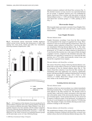 ablation treatment combined with blood flow occlusion (Fig. 3).
The absolute increase in tissue necrosis was equivalent between
the two groups. A quadratic function curve was established by
logistic regression to best correlate with data points in both the
thermal ablation alone (r = 0.89) and thermal ablation combined
with blood flow occlusion groups (r = 0.86), peaking at 48 h
(Fig. 3).
Microvascular changes
Microvascular injury assessment consisted of laser Doppler flow-
metry, SEM of vascular resin casts and tissue oxygen tension
measurements.
Laser Doppler flowmetry
Thermal ablation alone
Doppler flowmetery recordings 2 mm from the fibre insertion
site corresponded to the margin of coagulated liver tissue. Meas-
urement at 4 mm was in macroscopically normal tissue. There was
a dramatic relative reduction in blood flow 2 mm from the fibre
site immediately following thermal ablation (Fig. 4). The reduc-
tion in blood flow at 4 mm from the fibre site was, however, less
pronounced. At 72 h there was further reduction in blood flow at
2 mm from the fibre insertion site, in the region of fully developed
coagulative necrosis, compared to the immediate time point. The
blood flow was equivalent to normal liver at 4 mm from the fibre
insertion site at 72 h within macrocopically normal tissue, just
beyond the coagulated tissue margins.
Thermal ablation with blood flow occlusion
The relative blood flow changes following thermal ablation com-
bined with vascular inflow occlusion was similar to that observed
for treatment of liver by thermal ablation alone (Fig. 4). The
relative blood flow reduction 2 mm from the fibre insertion site
immediately after laser application was, however, significantly
greater with thermal ablation combined with blood flow occlusion
compared to thermal ablation alone (27.3 (7.6)% vs 38.5
(16.6)%); P = 0.002). Blood flow changes at later time points
were similar in the treatment groups.
Scanning electron microscopy
Thermal ablation alone
Disruption of the liver microvasculature was evident immediately
following treatment (Fig. 5). Vascular destruction was most prom-
inent adjacent to the fibre insertion site. The absolute extent of
vascular injury could not be clearly ascertained at this time point
due to the patchy nature of the microvascular damage at the mar-
gin of treated regions. Vessels greater than 60 lm were preserved
in regions of otherwise major vessel destruction. An expansion in
the area of vessel disruption was clearly evident by 72 h following
injury. The margins of injury were distinct allowing accurate meas-
urement of damage at this time point.
Thermal ablation with blood flow occlusion
The morphological changes in the extent of injury following ther-
mal ablation treatment combined with blood flow occlusion were
similar to those observed with thermal ablation therapy alone. The
Fig. 2. Nicotinamide adenine dinucleotide (NADH) diaphorase
stained cryostat section showing clear demarcation of viable, blue
staining liver, from poorly stained non-viable liver immediately
following treatment (magnification ·200).
Fig. 3. (A) Comparison of the diameter of necrosis produced by (h)
thermal ablation treatment alone and (j) thermal ablation with blood
flow occlusion at different time points. Mann–Whitney U-test. (B) A
quadratic function curve best correlates with the change in diameter
of necrosis following thermal ablation therapy alone (r = 0.89) and
thermal ablation combined with blood flow occlusion (r = 0.89). The
differences in the extent of necrosis are maintained between groups
and the peak injury occurs at 2 days following therapy.
THERMAL ABLATION WITH BLOOD FLOW OCCLUSION 87
Ó 2006 Royal Australasian College of Surgeons
 