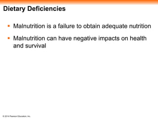 © 2014 Pearson Education, Inc.
Dietary Deficiencies
 Malnutrition is a failure to obtain adequate nutrition
 Malnutrition can have negative impacts on health
and survival
 