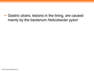 © 2014 Pearson Education, Inc.
 Gastric ulcers, lesions in the lining, are caused
mainly by the bacterium Helicobacter pylori
 
