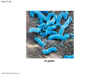© 2014 Pearson Education, Inc.
Figure 41.18a
H. pylori
 