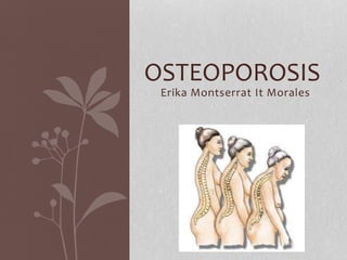 Erika Montserrat It Morales
OSTEOPOROSIS
 