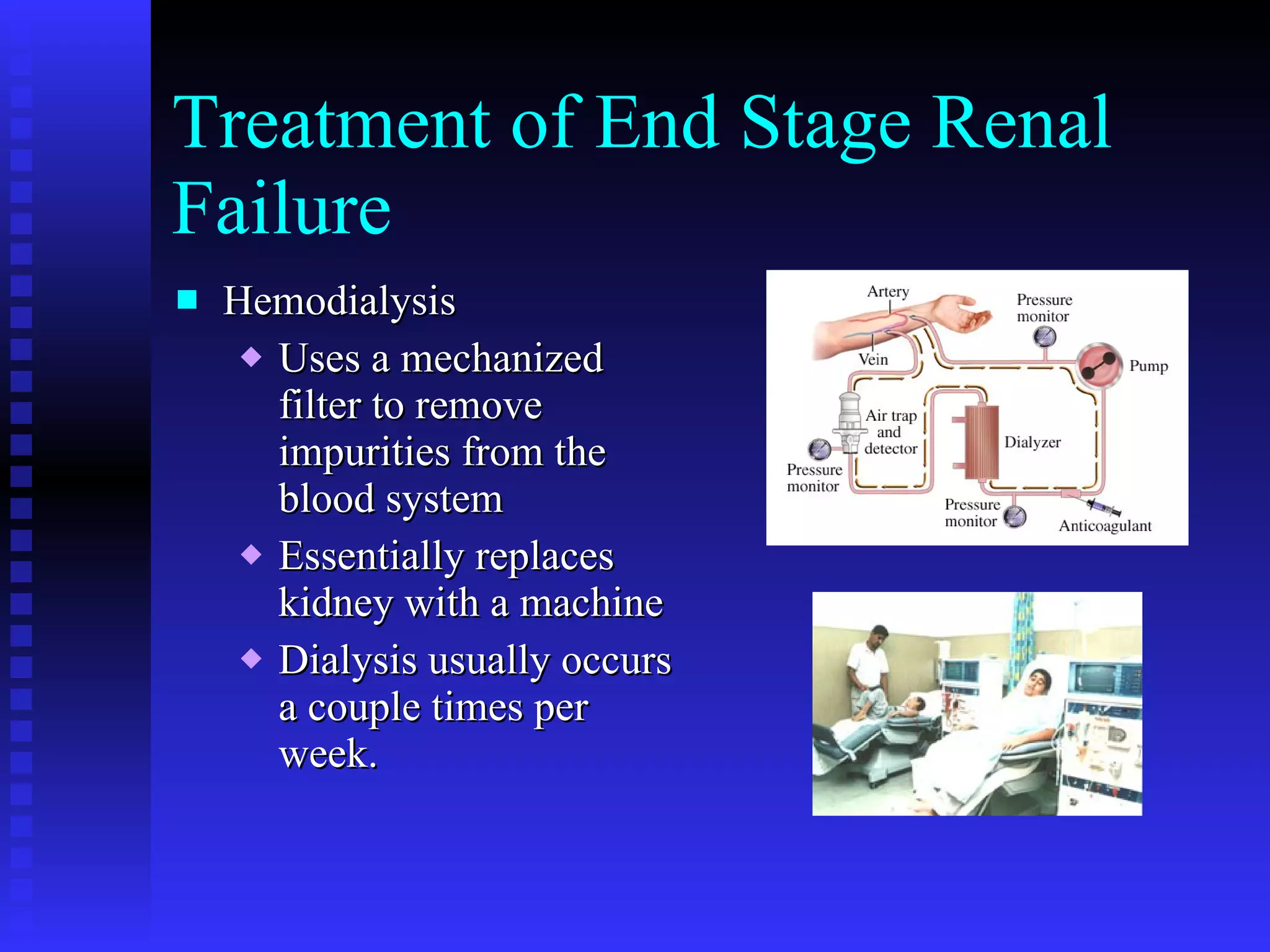Treatment of End Stage Renal Failure Hemodialysis Uses a mechanized filter to remove impurities from the blood system Essentially replaces kidney with a machine Dialysis usually occurs a couple times per week. 