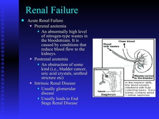 Renal Failure Acute Renal Failure Prerenal azotemia An abnormally high level of nitrogen-type wastes in the bloodstream. It is caused by conditions that reduce blood flow to the kidneys. Postrenal azotemia An obstruction of some kind (i.e., bladder cancer, uric acid crystals, urethral stricture etc) Intrinsic Renal Disease Usually glomerular disease Usually leads to End Stage Renal Disease 