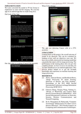 Skin Cancer Detection using Image Processing in Real Time | PDF