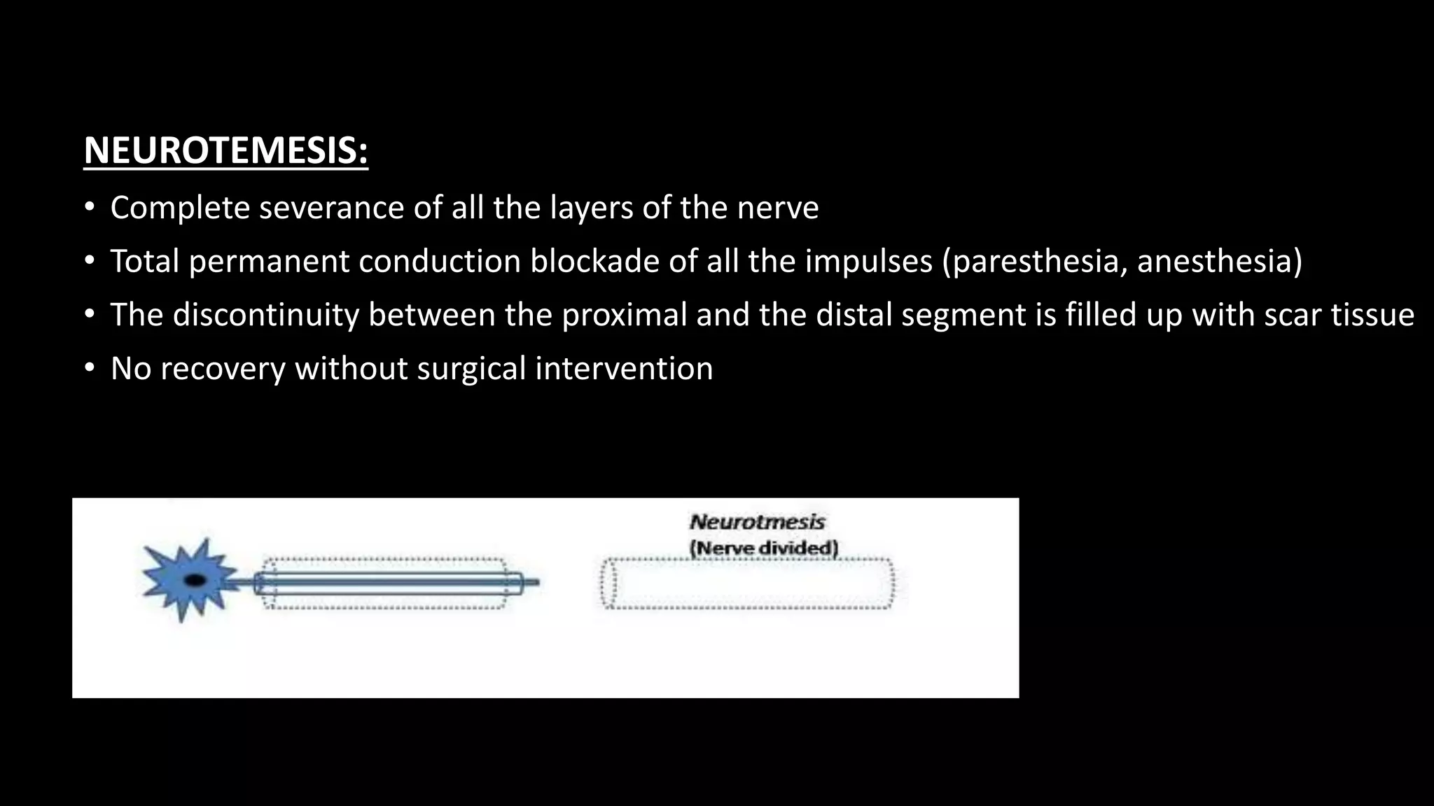NEUROTEMESIS:
• Complete severance of all the layers of the nerve
• Total permanent conduction blockade of all the impulses (paresthesia, anesthesia)
• The discontinuity between the proximal and the distal segment is filled up with scar tissue
• No recovery without surgical intervention
 