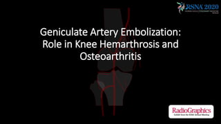 Geniculate Artery Embolization:
Role in Knee Hemarthrosis and
Osteoarthritis
 