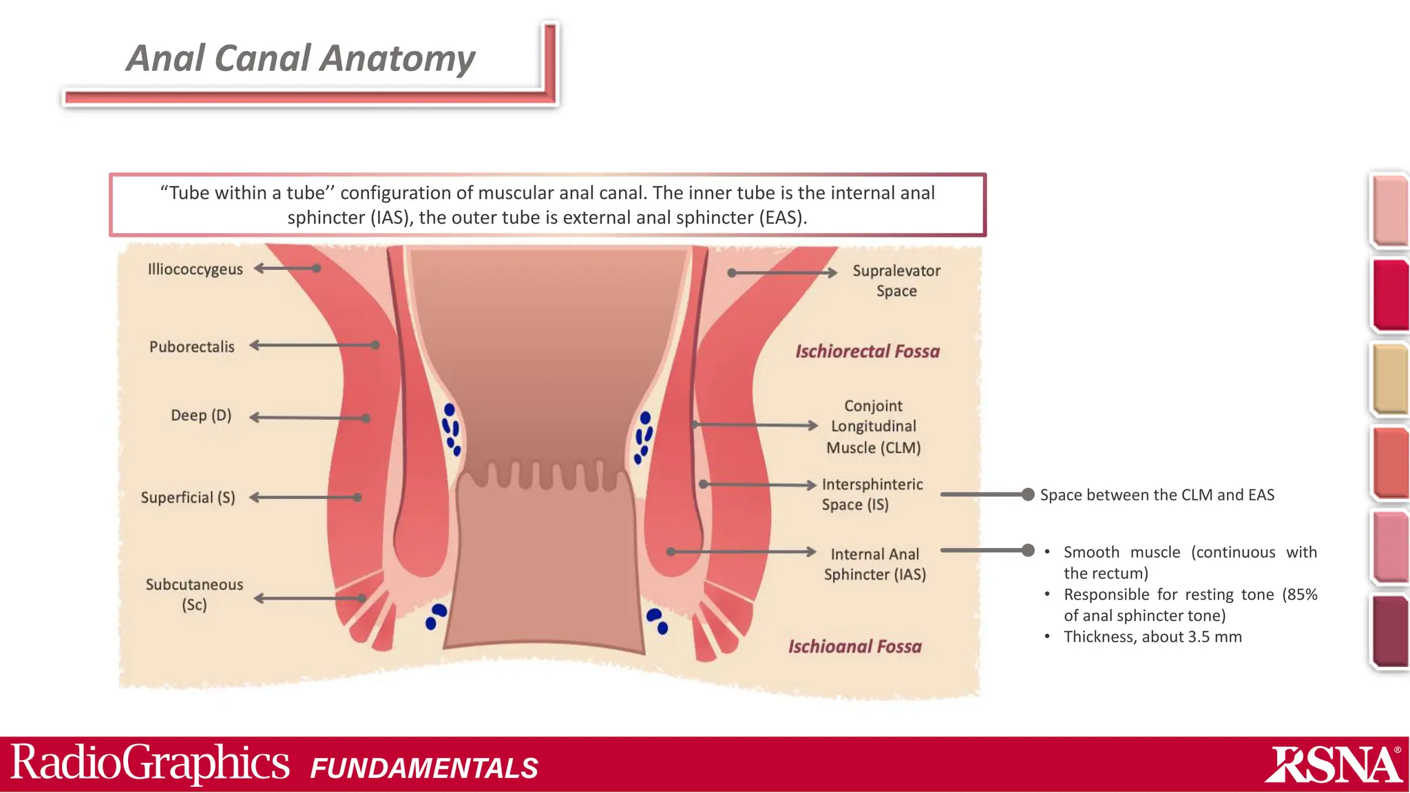 Perianal fistula and Abscess.pptx