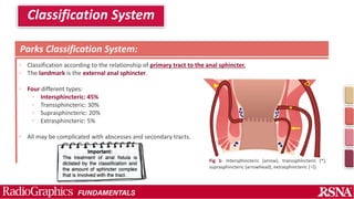 Parks Classification Perianal fistula and Abscess.pptx