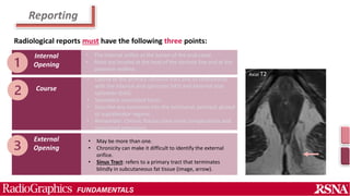 Remember Rafice Perianal fistula and Abscess.pptx