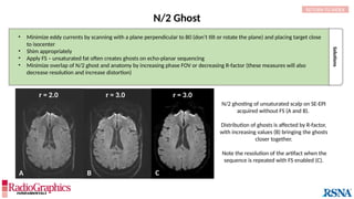 A B
r = 2.0 r = 3.0 r = 3.0
C
Solutions
N/2 Ghost
• Minimize eddy currents by scanning with a plane perpendicular to B0 (don’t tilt or rotate the plane) and placing target close
to isocenter
• Shim appropriately
• Apply FS – unsaturated fat often creates ghosts on echo-planar sequencing
• Minimize overlap of N/2 ghost and anatomy by increasing phase FOV or decreasing R-factor (these measures will also
decrease resolution and increase distortion)
RETURN TO INDEX
N/2 ghosting of unsaturated scalp on SE-EPI
acquired without FS (A and B).
Distribution of ghosts is affected by R-factor,
with increasing values (B) bringing the ghosts
closer together.
Note the resolution of the artifact when the
sequence is repeated with FS enabled (C).
 