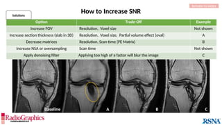 A B C
Baseline
How to Increase SNR
C D
Option Trade-Off Example
Increase FOV Resolution, Voxel size Not shown
Increase section thickness (slab in 3D) Resolution, Voxel size, Partial volume effect (oval) A
Decrease matrices Resolution, Scan time (PE Matrix) B
Increase NSA or oversampling Scan time Not shown
Apply denoising filter Applying too high of a factor will blur the image C
Solutions
RETURN TO INDEX
 
