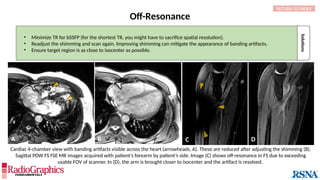 Off-Resonance
Cardiac 4-chamber view with banding artifacts visible across the heart (arrowheads, A). These are reduced after adjusting the shimming (B).
Sagittal PDW FS FSE MR images acquired with patient’s forearm by patient’s side. Image (C) shows off-resonance in FS due to exceeding
usable FOV of scanner. In (D), the arm is brought closer to isocenter and the artifact is resolved.
A B
Solutions
• Minimize TR for bSSFP (for the shortest TR, you might have to sacrifice spatial resolution).
• Readjust the shimming and scan again. Improving shimming can mitigate the appearance of banding artifacts.
• Ensure target region is as close to isocenter as possible.
RETURN TO INDEX
C D
 