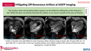 Mitigating Off-Resonance Artifact at bSSFP Imaging
Cardiac 4-chamber view with different center frequency offset: (A) base image at 0 ppm; (B) -0.5 ppm shift; (C) -1.0
ppm shift; (D) -1.5 ppm shift. In this case, banding artifacts were shifted outside of the volume of interest by using
applying the -1.0 ppm f0 offset.
A B C D
Solutions
The location where the banding artifact appears can be shifted by shifting the center frequency
(f0). While this does not directly minimize the artifact, it can move it outside of the area of interest.
f0 offset = 0 f0 offset = -1.0 f0 offset = -1.5
- + - +
f0 offset = -0.5
- + - +
RETURN TO INDEX
Focus on:
Water
Fat Water
Fat Water
Fat Water
Fat
 
