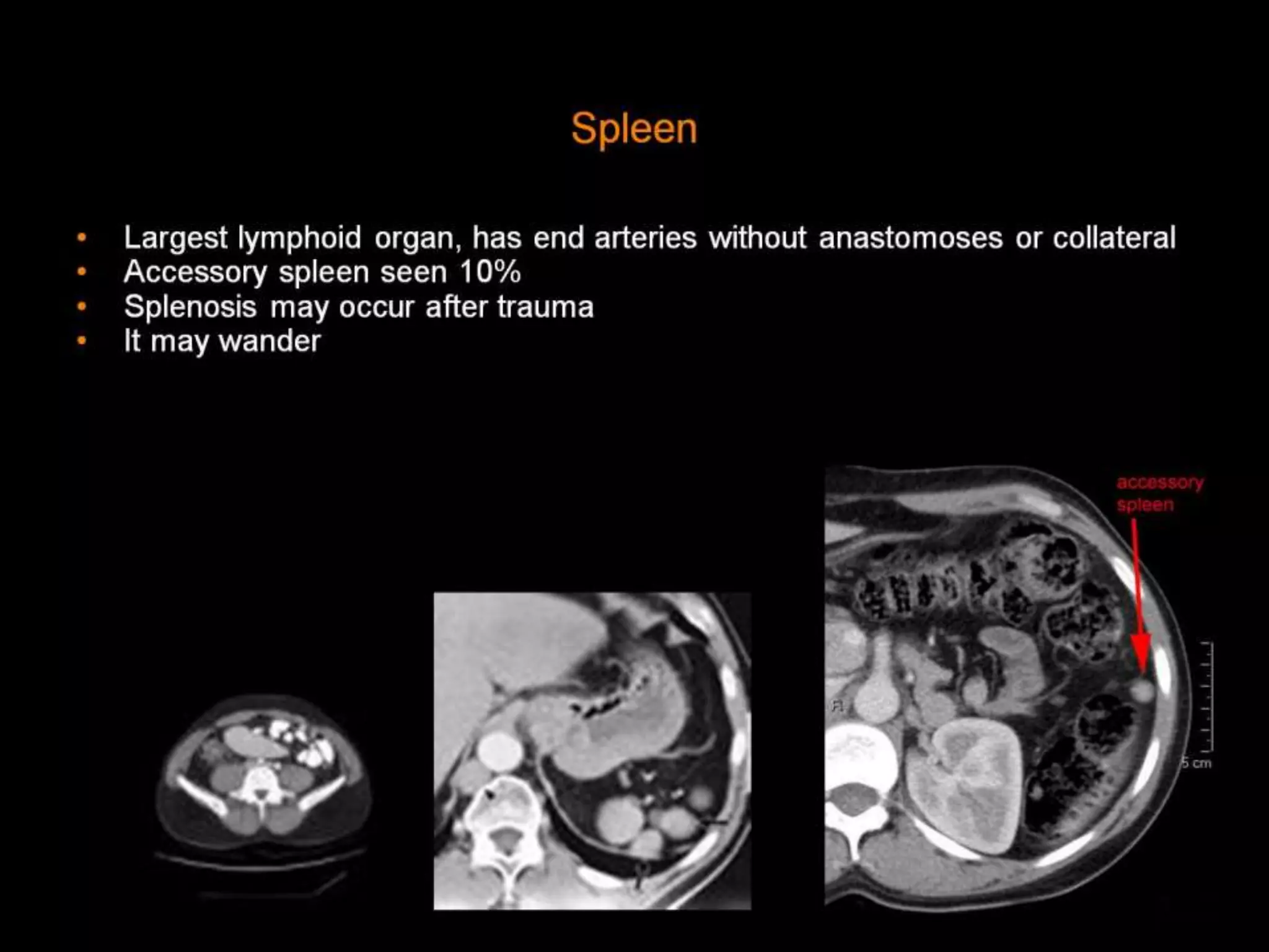 42-Dr Ahmed Esawy imaging oral board of splenic peritoneum imaging ...