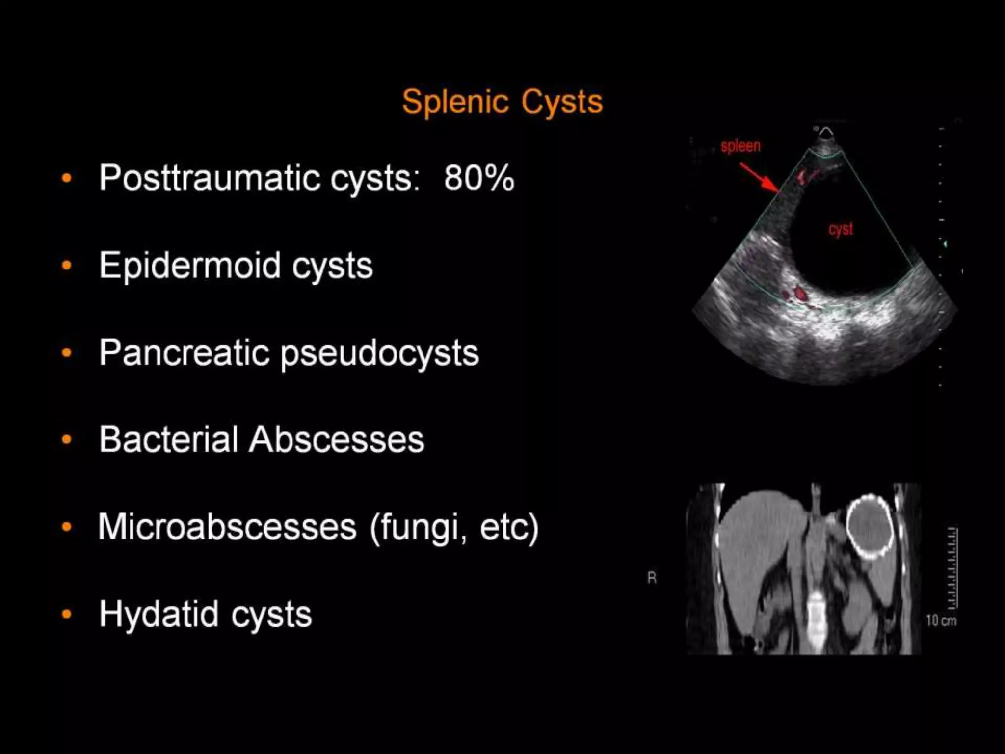 42-Dr Ahmed Esawy imaging oral board of splenic peritoneum imaging ...