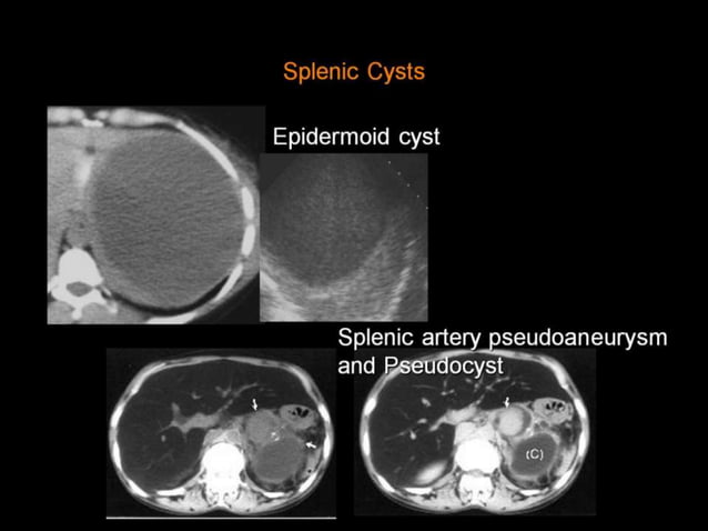 42-Dr Ahmed Esawy imaging oral board of splenic peritoneum imaging ...