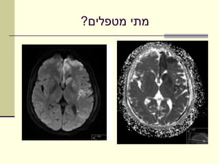 ‫מתי מטפלים?‬
 