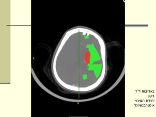 ‫באדיבות ד"ר‬
         ‫בקון‬
‫יחידת הנוירו-‬
‫אינטרבנשיונל‬
 