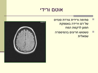 ‫אוטם ורידי‬
      ‫סתימה ורידית גוררת סטזיס‬   ‫‪‬‬
          ‫של דם וירידה באספקת‬
             ‫חמצן לרקמת המח‬
       ‫טשטוש חריצים בהמיספרה‬     ‫‪‬‬
                       ‫שמאלית‬
 