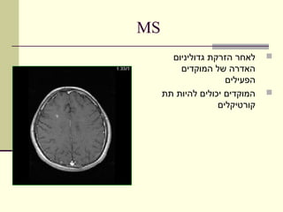 ‫‪MS‬‬
       ‫לאחר הזרקת גדוליניום‬    ‫‪‬‬
         ‫האדרה של המוקדים‬
                     ‫הפעילים‬
     ‫המוקדים יכולים להיות תת‬   ‫‪‬‬
                   ‫קורטיקלים‬
 