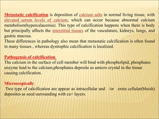 Metastatic calcification is deposition of calcium salts in normal living tissue, with
elevated serum levels of calcium, which can occur because abnormal calcium
metabolism(hypercalacemia). This type of calcification happens when there is body
but principally affects the interstitial tissues of the vasculature, kidneys, lungs, and
gastric mucosa.
These differences in pathology also mean that metastatic calcification is often found
in many tissues , whereas dystrophic calcification is localized.
Pathogensis of calcification
The calcium in the surface of cell member will bind with phospholipid, phosphates
enzyme lead to the calcium,phosphates deposite as amicro crystal in the tissue
causing calcification.
Microscopically
Two type of calcification are appear as intracellular and /or extra cellular(bluish)
deposites as seed surrounding with ca+ layers.
 