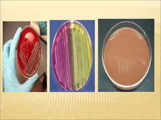 MACCONKEY AGAR(LACTOSE FERMENT IS PINK AND NON
LACTOSE FERMENT IS YELLOW)
 