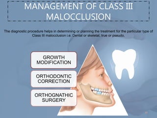 Comprehensive Management of Class III Malocclusion in Orthodontics | PDF